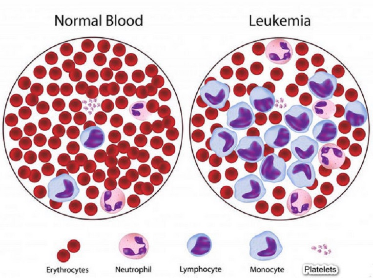 mean-platelet-volume-mpv-diagnostics-centre-habra-diagnostics